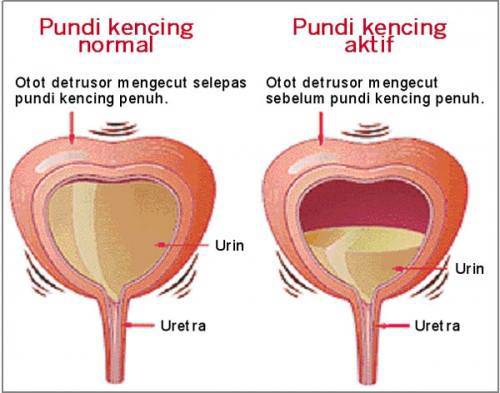 tahan-kencing-3